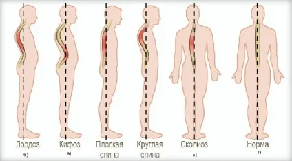 Ефективні вправи для постави в домашніх умовах