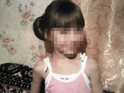 Експертиза показала, що дівчинку, розтерзану собаками на Уралі, покусали два пса