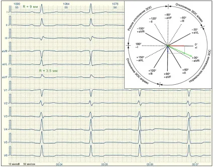 E-cardio урок 7 (електрична вісь)