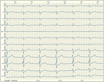 E-cardio урок 7 (електрична вісь)