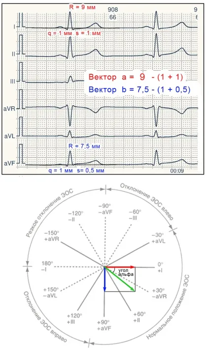 E-cardio урок 7 (електрична вісь)