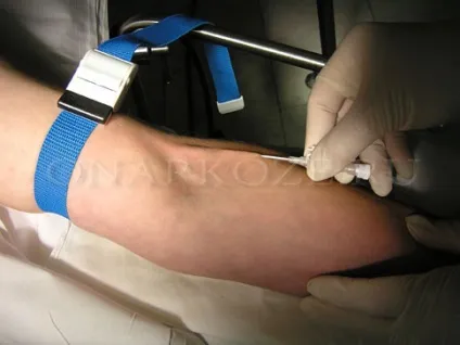 Фото пункції вен - вся правда про наркоз (яка фіксує пов'язка для катетера) Фото пункції вен - вся правда про наркоз