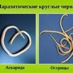 Гельмінти у людини симптоми, лікування і діагностика паразитів в організмі (лікування) Гельмінти у людини симптоми, лікування і діагностика паразитів в організмі
