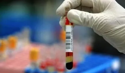 Гіпоплазія яєчок як лікувати (яєчок) Гіпоплазія яєчок як лікувати
