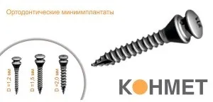 Імпланти КОНМЕТ (conmet) переваги, установка, відгуки, ціна (КОНМЕТ каталог) Імпланти КОНМЕТ (conmet) переваги, установка, відгуки, ціна