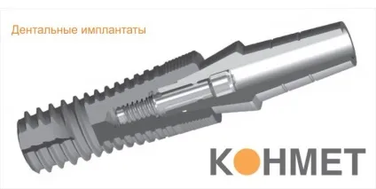 Імпланти КОНМЕТ (conmet) переваги, установка, відгуки, ціна (КОНМЕТ імплантати офіційний сайт) Імпланти КОНМЕТ (conmet) переваги, установка, відгуки, ціна