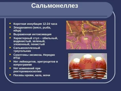 Інфекційний коліт симптоми, лікування інфекційного коліту кишечника (лікування) Інфекційний коліт симптоми, лікування інфекційного коліту кишечника
