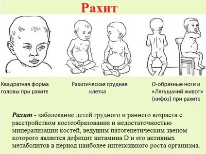 Які препарати кальцію призначені для дітей (кальцію) Які препарати кальцію призначені для дітей
