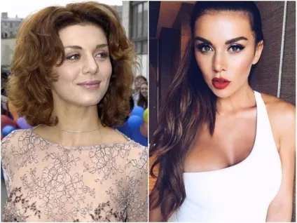 українські знаменитості, схиблені на пластиці, яких не впізнати на старих фото, умкра (старих) українські знаменитості, схиблені на пластиці, яких не впізнати на старих фото, умкра