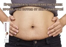Найефективніші процедури від розтяжок в домашніх умовах