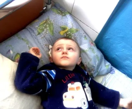 Як вилікувати кісту головного мозку у немовлят (мозку) Як вилікувати кісту головного мозку у немовлят