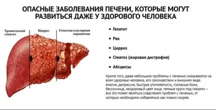 Як відновити печінку після тривалого вживання алкоголю (після) Як відновити печінку після тривалого вживання алкоголю
