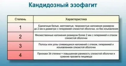 Кандидозний езофагіт - види, причини, симптоми, лікування (езофагіт) Кандидозний езофагіт - види, причини, симптоми, лікування