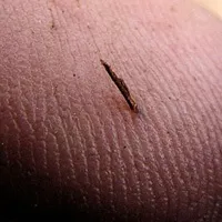 До чого сниться скалка в пальці на руці і нозі уві сні бачити до чого сниться (нозі) До чого сниться скалка в пальці на руці і нозі уві сні бачити до чого сниться
