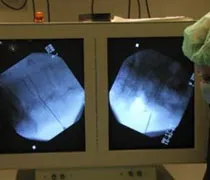 Klinik und poliklinik fuer neurochirurgie інформація для пацієнтів (neurochirurgie) Klinik und poliklinik fuer neurochirurgie інформація для пацієнтів