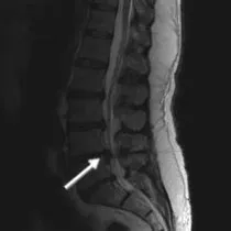 Klinik und poliklinik fuer neurochirurgie інформація для пацієнтів (fuer) Klinik und poliklinik fuer neurochirurgie інформація для пацієнтів