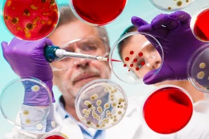Кашлюк - збудник (bordetella pertussis), епідеміологія захворювання (pertussis) Кашлюк - збудник (bordetella pertussis), епідеміологія захворювання