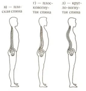 Кругловогнутая і плосковогнутим спина плоска спина у дитини, вправи (плосковогнутим) Кругловогнутая і плосковогнутим спина плоска спина у дитини, вправи