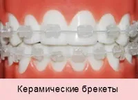 Лікування пульпіту (ціна, методи) - як лікують пульпіт (лікування) Лікування пульпіту (ціна, методи) - як лікують пульпіт