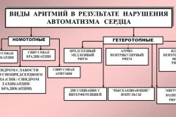 ЛФК при інфаркті міокарда