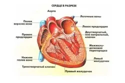 ЛФК при інфаркті міокарда