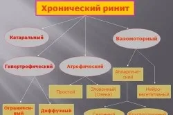 Лікування хронічного нежитю у дітей