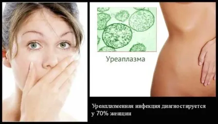 Лікування уреаплазмоза у жінок препарати і народні засоби (препарати) Лікування уреаплазмоза у жінок препарати і народні засоби