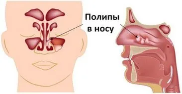 Слизова оболонка носа