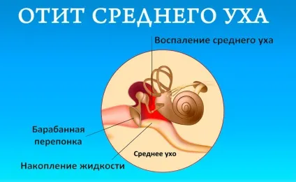 Слиз в носоглотці - причини скупчення і стікання по задній стінці (задній) Слиз в носоглотці - причини скупчення і стікання по задній стінці