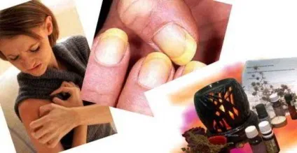Монарда лікувальні властивості і протипоказання рецепти, застосування (рецепти) Монарда лікувальні властивості і протипоказання рецепти, застосування