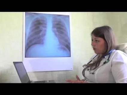 На який день перевіряють манту у дитини через скільки часу і як повинна виглядати (день) На який день перевіряють манту у дитини через скільки часу і як повинна виглядати