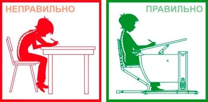 Порушення постави головні причини, види, лікування та профілактика (порушення) Порушення постави головні причини, види, лікування та профілактика