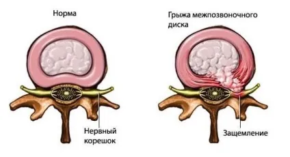 Порушення постави головні причини, види, лікування та профілактика (види) Порушення постави головні причини, види, лікування та профілактика