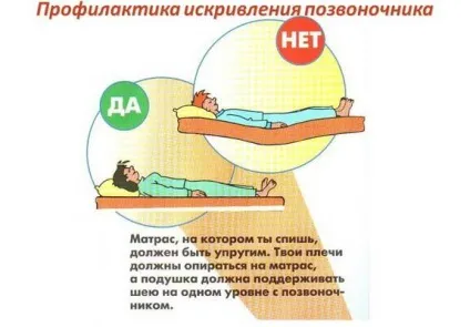 Порушення постави головні причини, види, лікування та профілактика (порушення) Порушення постави головні причини, види, лікування та профілактика