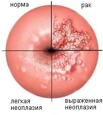 німіють руки