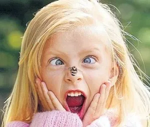 Невідкладна допомога при набряку Квінке (невідкладна допомога при набряку Квінке алгоритм) Невідкладна допомога при набряку Квінке
