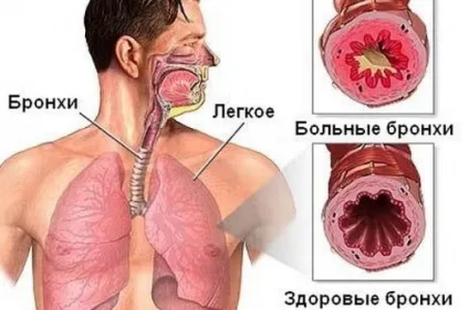 Нігті стали опуклими - ознака серйозного захворювання, красиві нігті - додаток твого образу (ознака) Нігті стали опуклими - ознака серйозного захворювання, красиві нігті - додаток твого образу