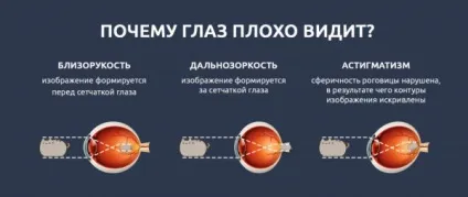 Окуляри в дірочку для поліпшення зору (перфораційні) допомагають відновити, інструкція, як (окуляри) Окуляри в дірочку для поліпшення зору (перфораційні) допомагають відновити, інструкція, як