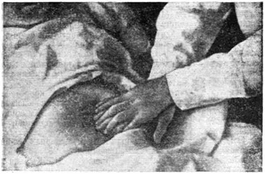 Зупинка кровотечі в післяпологовому періоді (частина 1) (післяпологовому) Зупинка кровотечі в післяпологовому періоді (частина 1)
