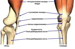 Перелом великогомілкової кістки (великогомілкової) Перелом великогомілкової кістки