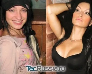 Пластичні операції евгении Феофілактова - фото до і після - твій путівник у блогосфері (операції) Пластичні операції евгении Феофілактова - фото до і після - твій путівник у блогосфері