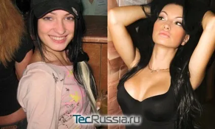 Пластичні операції евгении Феофілактова - фото до і після - твій путівник у блогосфері (евгении) Пластичні операції евгении Феофілактова - фото до і після - твій путівник у блогосфері
