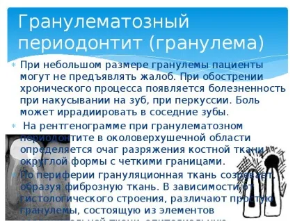 Презентація по темі періодонтит (періодонтит) Презентація по темі періодонтит