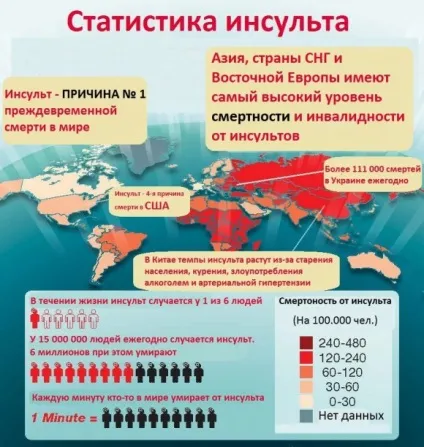 Передумови інсульту у жінок і чоловіків
