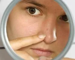 Прищі на обличчі сигналізують про хвороби внутрішніх органів, новини на (прищі) Прищі на обличчі сигналізують про хвороби внутрішніх органів, новини на