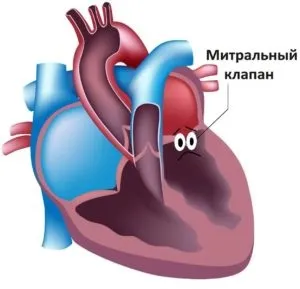Пролапс мітрального клапана види, причини, симптоми і лікування (пролапс) Пролапс мітрального клапана види, причини, симптоми і лікування