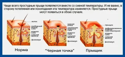 Простудні прищі на обличчі фото, як позбутися