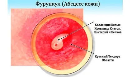 Простудні прищі на обличчі фото, як позбутися