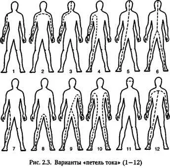 Шляхи проходження електричного струму по організму людини (петлі струму) (шляху) Шляхи проходження електричного струму по організму людини (петлі струму)