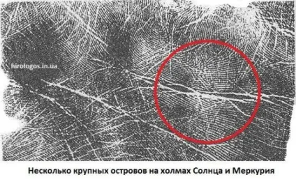 Пляма, острівці на лінії серця (серця) Пляма, острівці на лінії серця